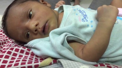 jaundice symptoms in newbborn baby