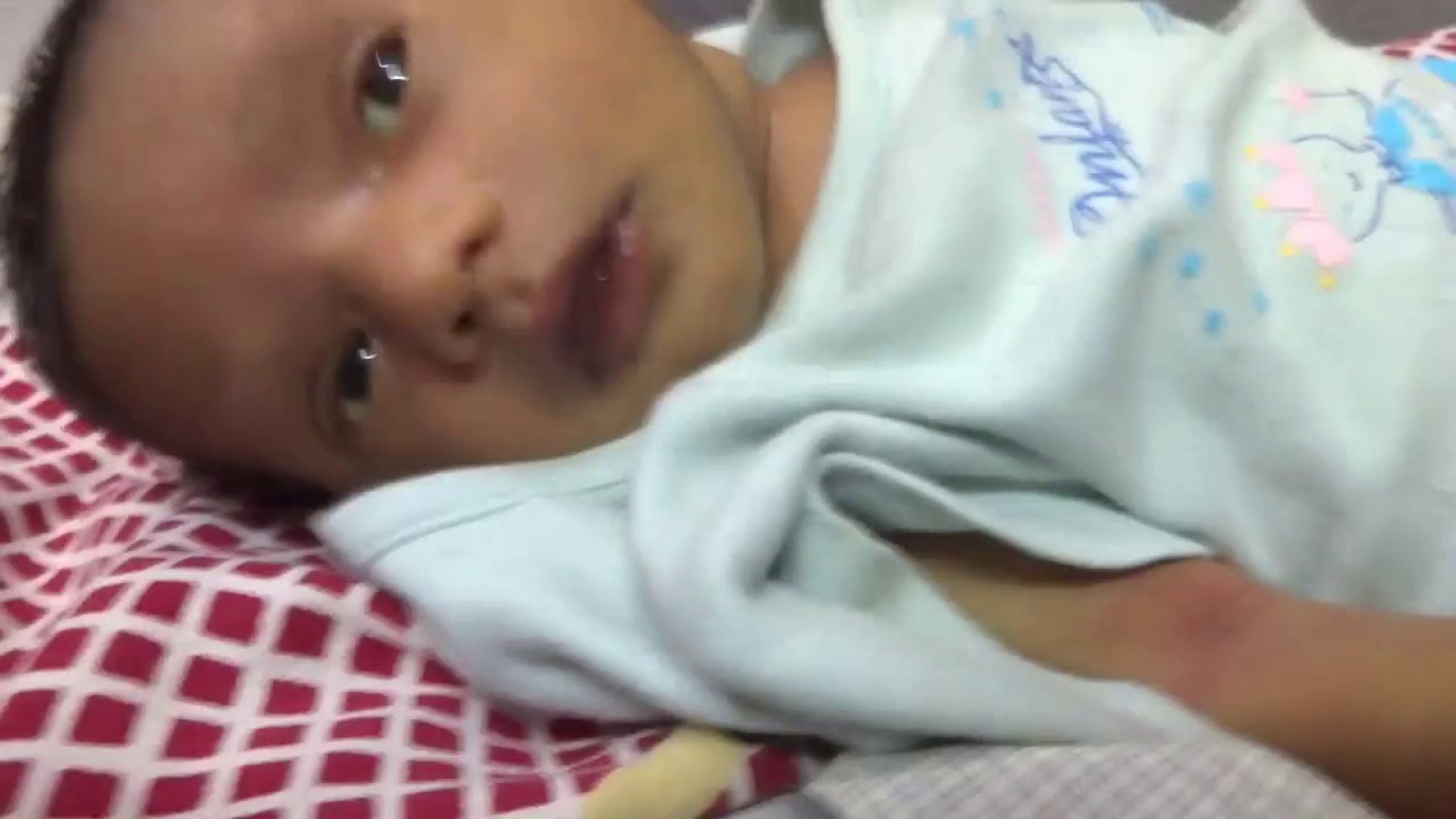 ⁣how to check jaundice in baby