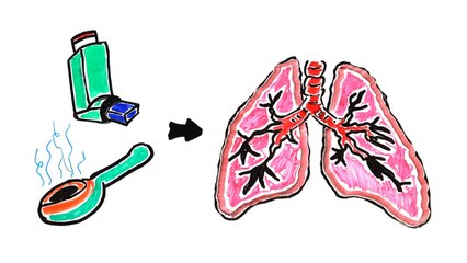 Your Brain on Crack Cocaine