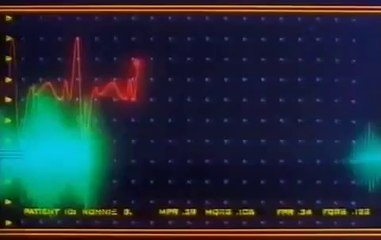 La Mosca 2 Online Audio Latino - YouTube