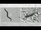 Chromosome 4 - How a worm is unlocking the secrets of ageing