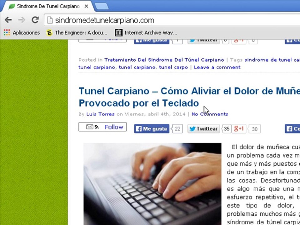 Sindrome del tunel capriano