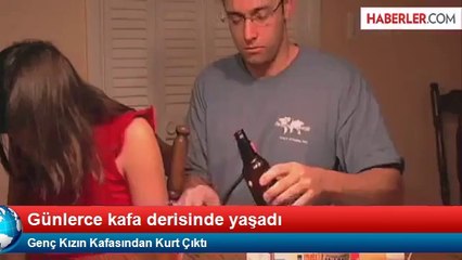 KAFASINDAN KURT ÇIKAN ADAM