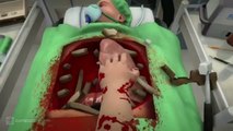 E3 2014 Game Trailers - Surgeon Simulator - Official Gameplay Trailer (HD 1080p) Sony PlayStation 4 [PS4]
