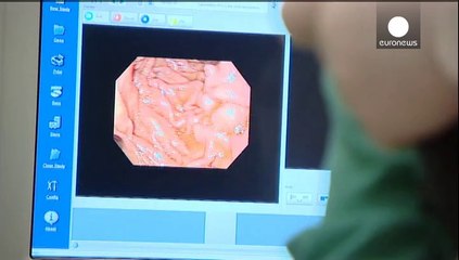 Le Botox, efficace dans la lutte contre le cancer de l'estomac