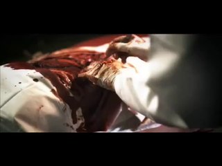 Sutures The Movie Trailer