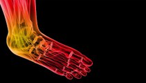Podiatrist in Baltimore, Reisterstown and Owings Mills, MD - Diabetic Foot Care