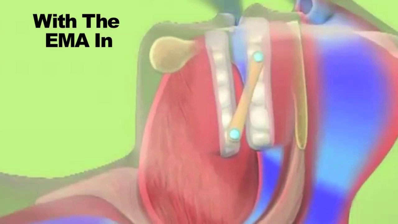 Best Dentist In Woodbury, MN -- How Does A Dentist Treat Snoring & Sleep Apnea?