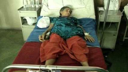 Inde: des médecins retirent un foetus 36 ans après la grossesse