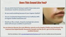 Get Rid of Angular Cheilitis - Best Angular Cheilitis Cure