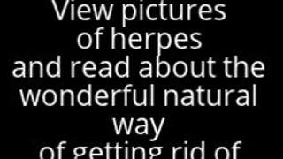 Pictures of Herpes and How to get rid of Herpes fast