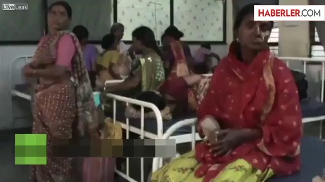 İki Yüzlü Doğan Bebek Yaşam Mücadelesi Veriyor