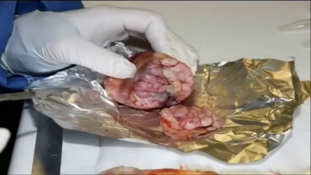 Estudio revela escandalosas consecuencias de consumir OGMs