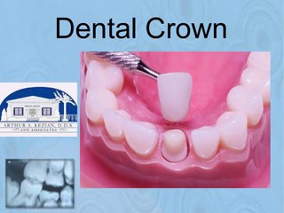 Types of Cosmetic Dentistry