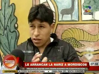 Hombre queda desfigura tras ser mordido violentamente en la nariz