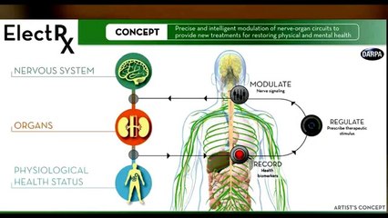 Next Generation Doctors Visits  done by Elect Rx intelligent Pacemaker