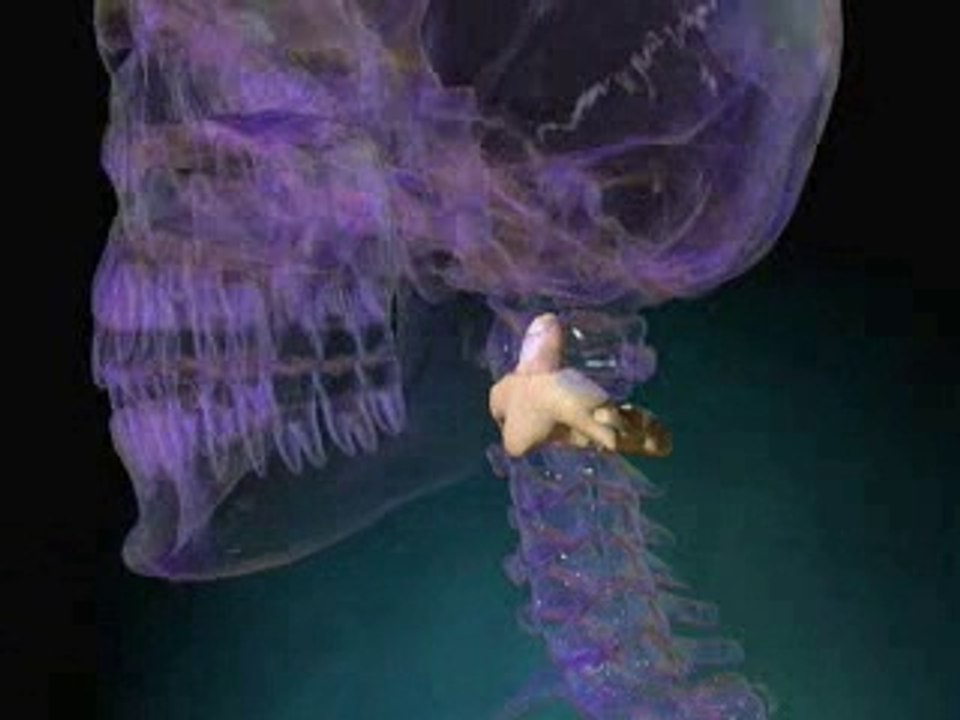 Cervical Spinal Stenosis Treatment- spinalstenosis.org