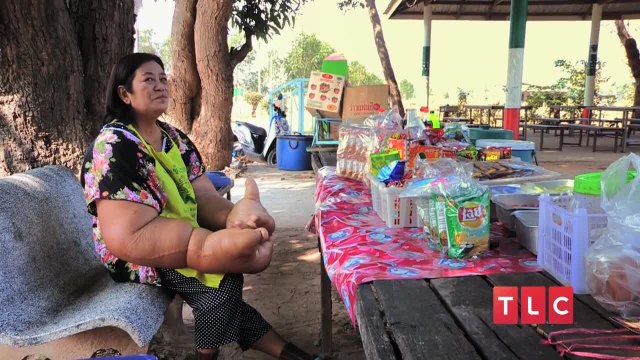 Les mains les plus grosses du monde - Body Bizarre