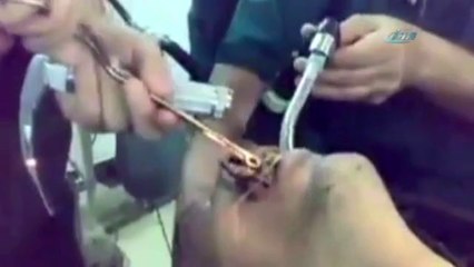 Midesinden Bakın Ne Çıktı