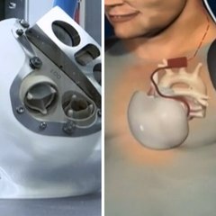 La saga du coeur artificiel en 3 étapes