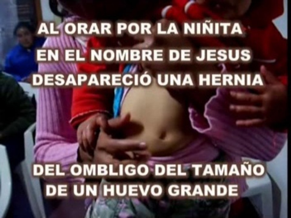 Curacion milagrosa de hernia umbilical