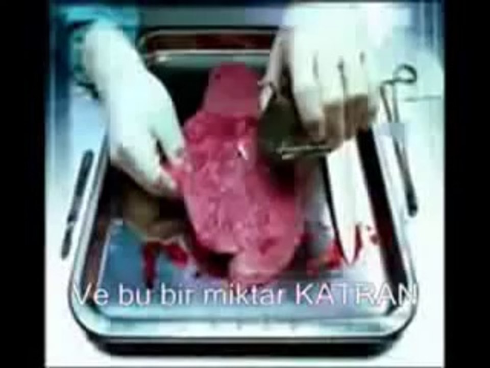 SİGARANIN ZARARLARI HİÇ BÖYLE GÖRMEDİNİZ httpwwwkumbagnet kumbağ