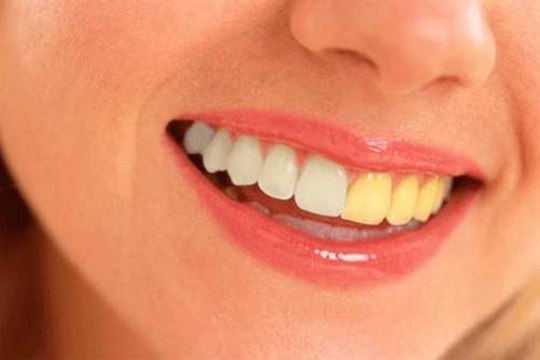 how to brighten and whiten teeth in photoshop