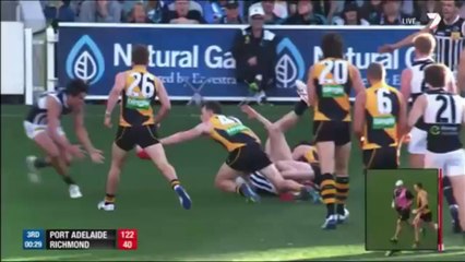 Football australien - Nathan Foley se fait exploser le nez