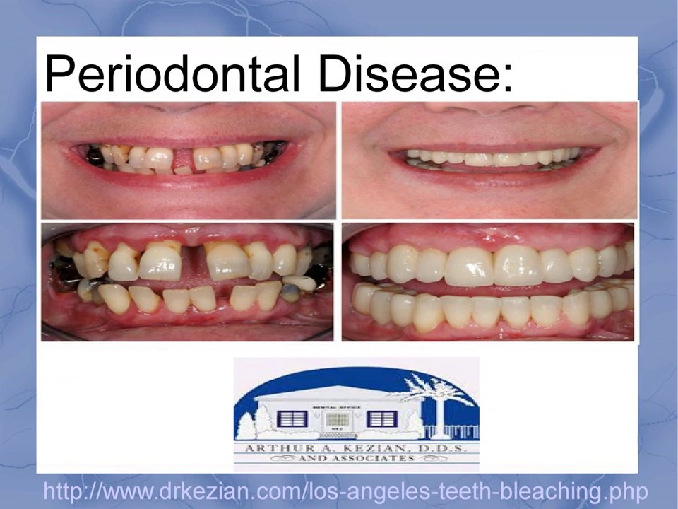 Dental Treatments and Procedures