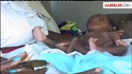 Dört Kollu Dört Bacaklı Bebek