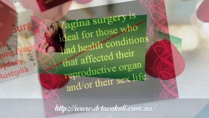 Labiaplasty procedure in Sydney