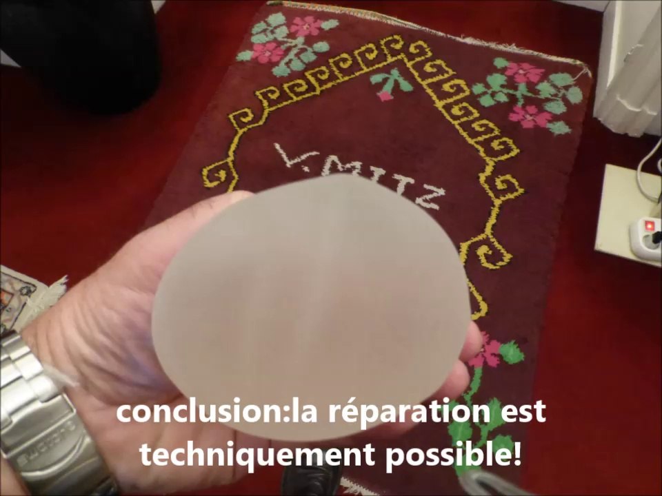 vagues après augmentation mammaire,correction par vladimir mitz