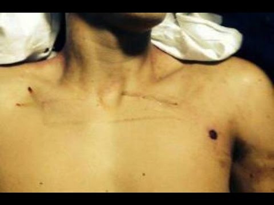 Napoli - Davide Bifolco, l'autopsia: "Proiettile entrato dal petto" (08.09.14)