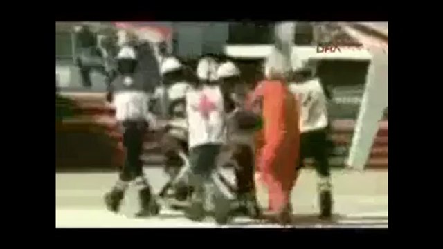 5 yaşındaki çocuğunun gözlerini oyan cani anneye hapis