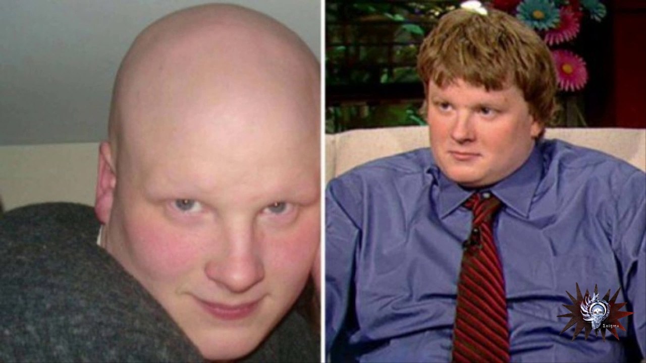 Un medicamento pone fin a la alopecia