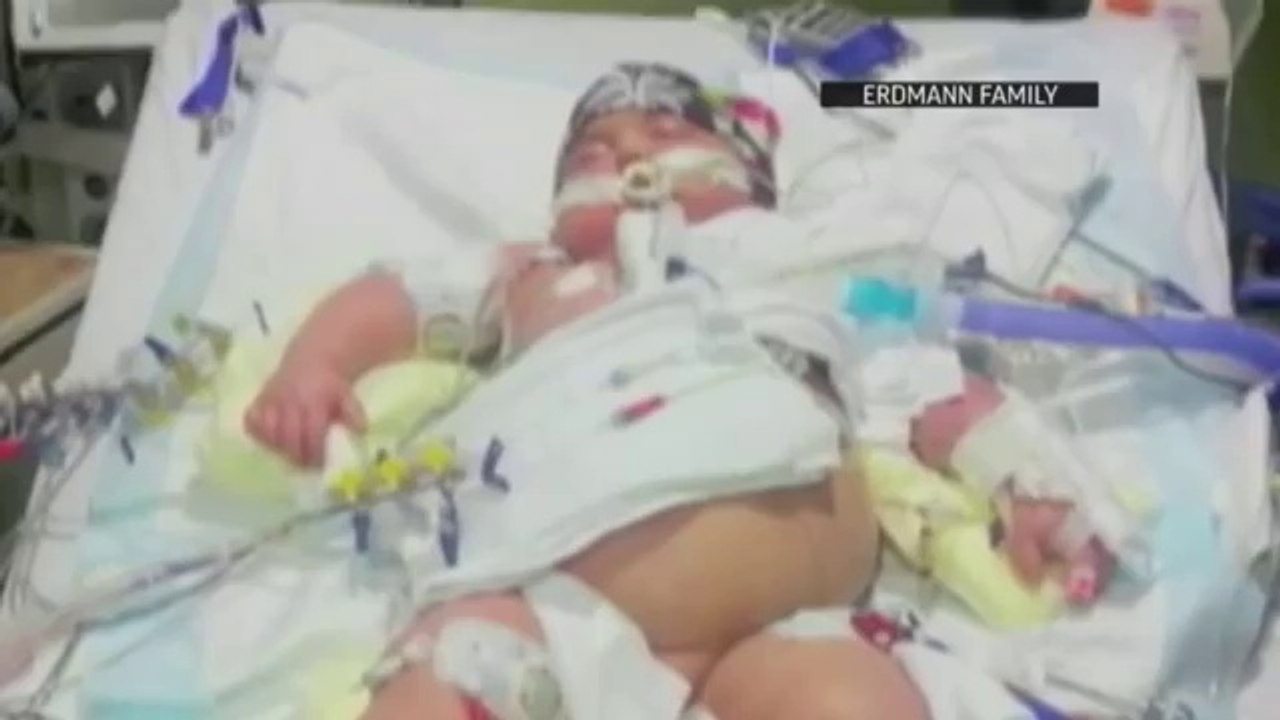 Cette petite fille rencontre pour la première fois le donneur qui lui a sauvé la vie