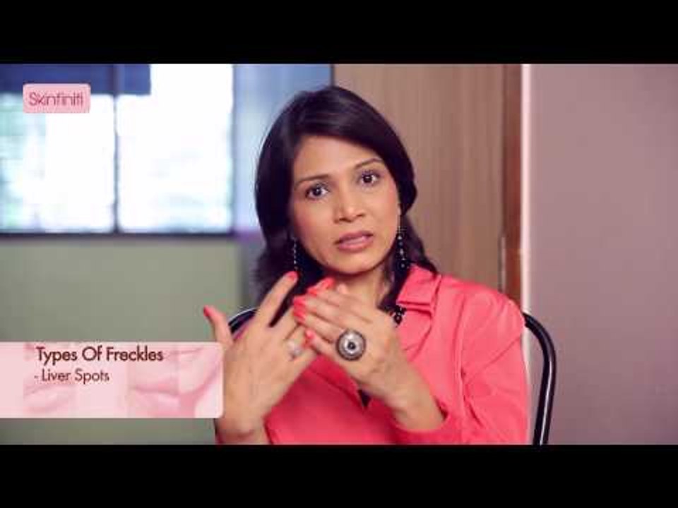 Dr. Jaishree Sharad || Freckles || Causes & Prevention || Skinfiniti