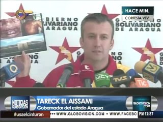 El Aissami: Fotos de supuesto virus en HCM son falsas