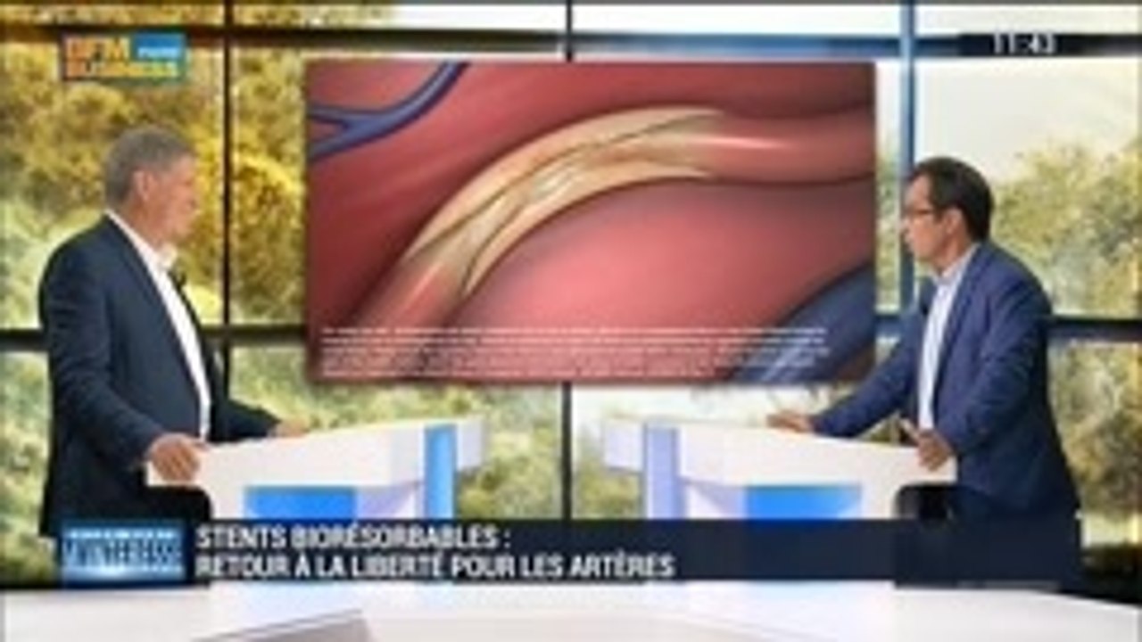 Les stents biorésorbables: nouveau traitement pour traiter les maladies des artères coronaires: Votre santé m'intéresse - 13/09
