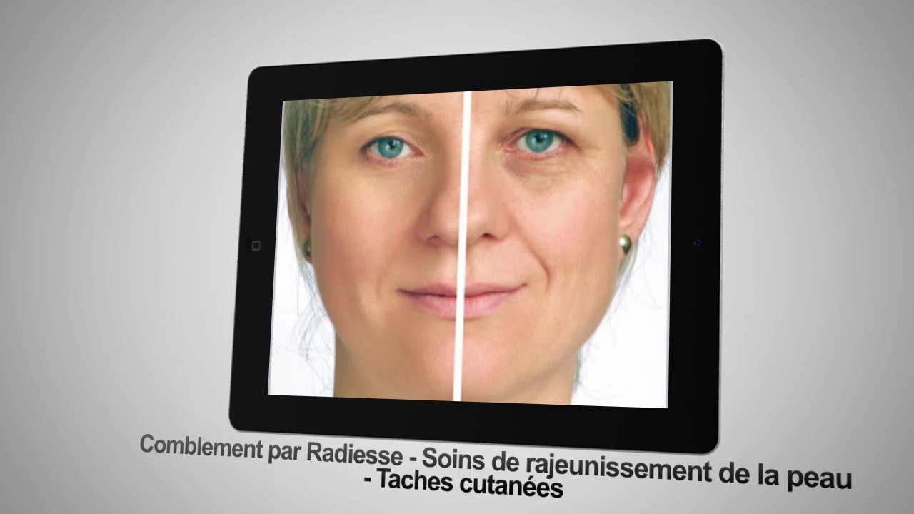 Médecine esthétique Cholet