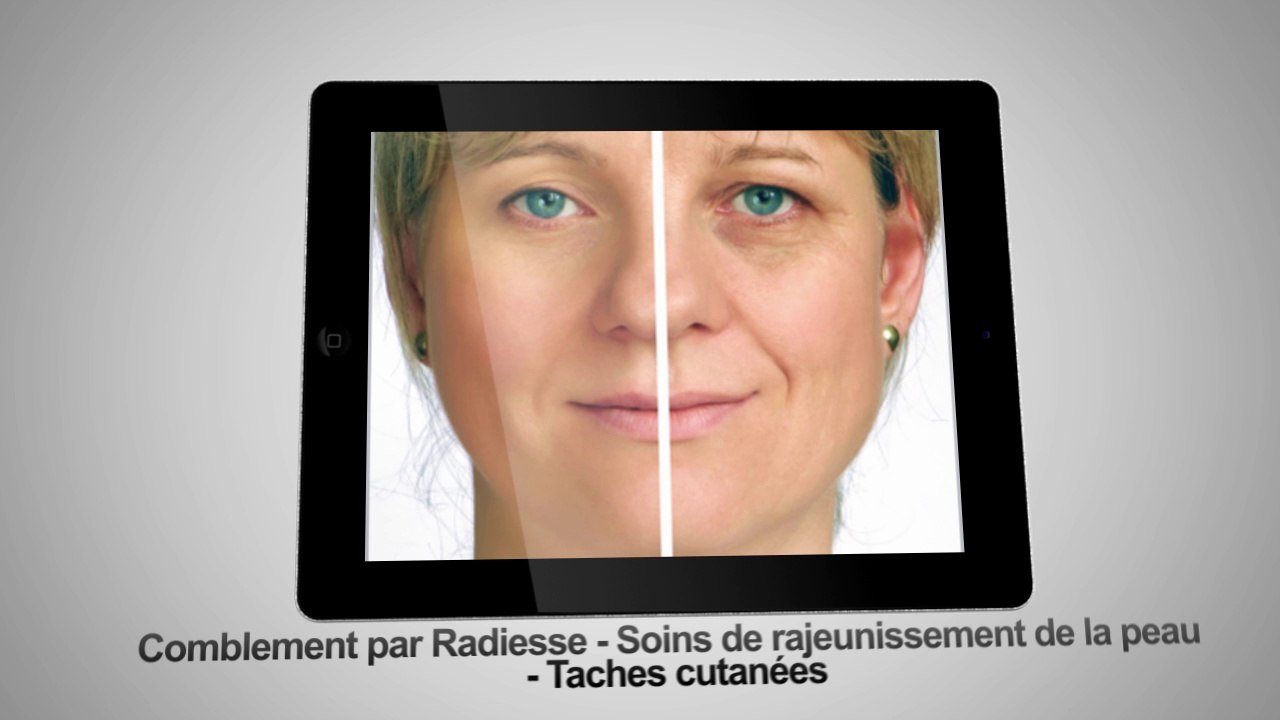 Médecine esthétique Nantes