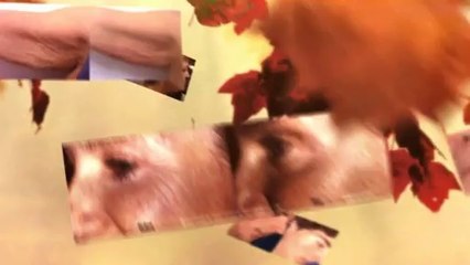 Laser Hair Removal Miami