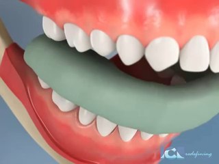 Cosmetic Dentistry Torrance ca