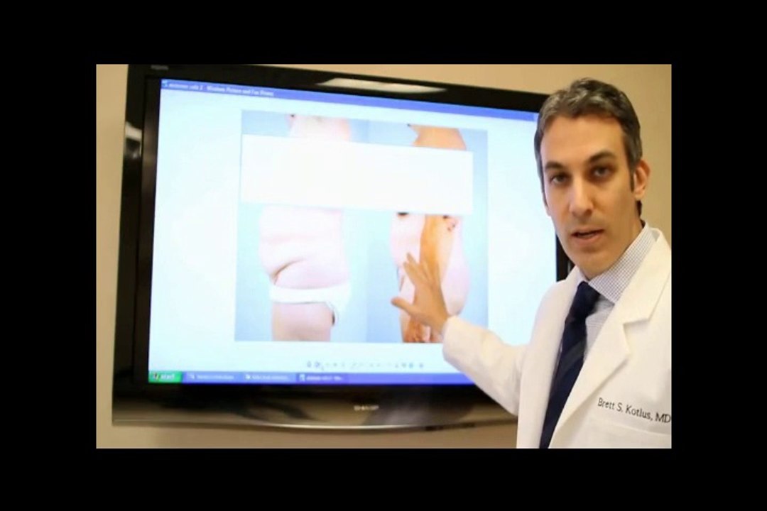 how to lose visceral fat Amazing Workout