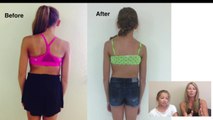 Scoliosis Treatment - Mission Viejo - Laguna Niguel
