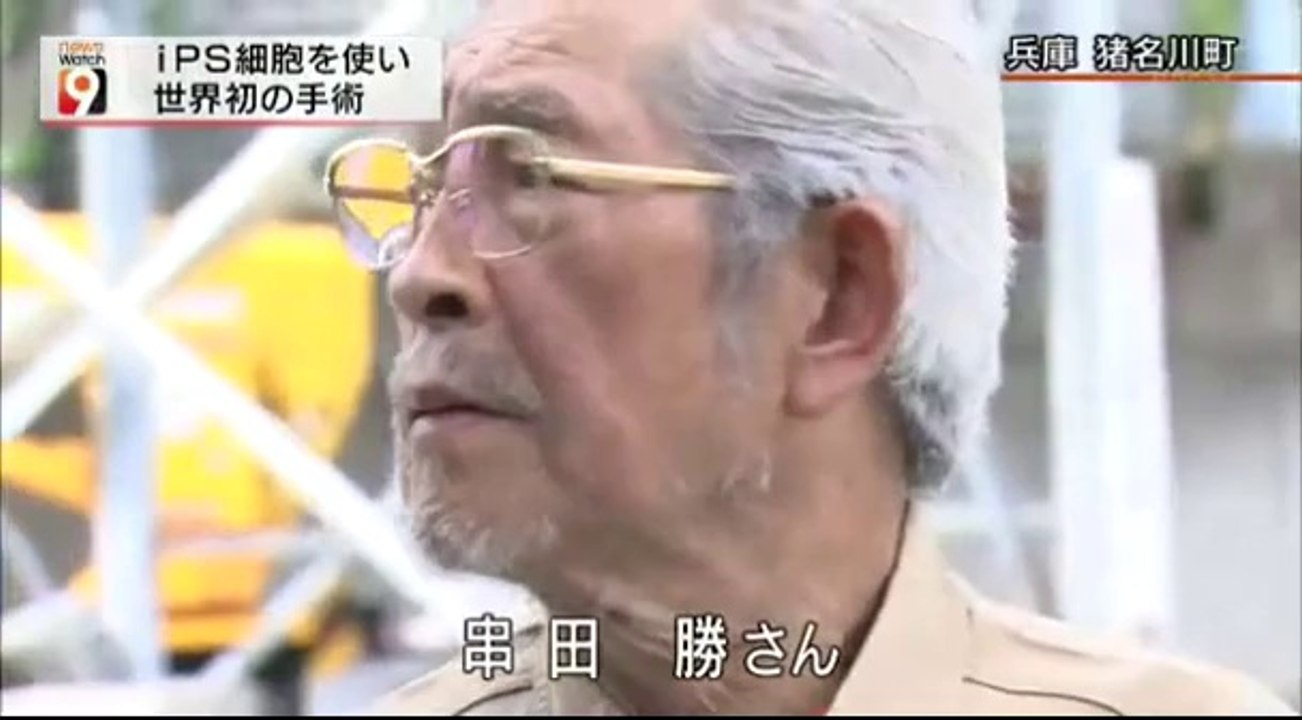 14 09 12 AK NW9  iPS細胞初手術　山中教授