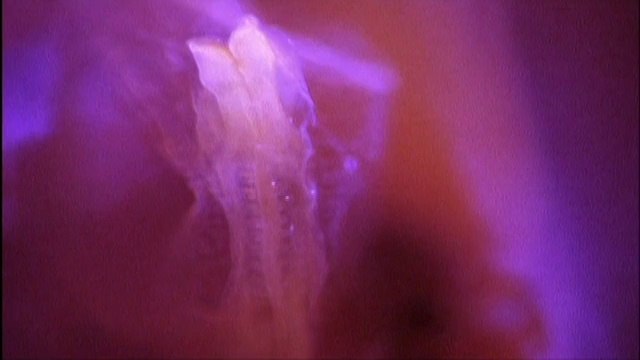 EN EL VIENTRE MATERNO PARTOS MULTIPLES