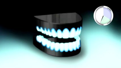 Teeth Whitening Los Banos California