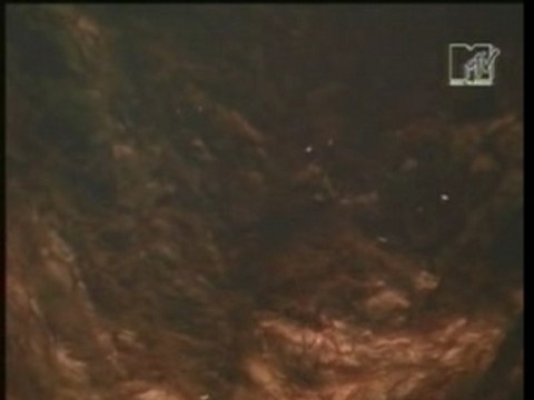 Massive Attack - Teardrop