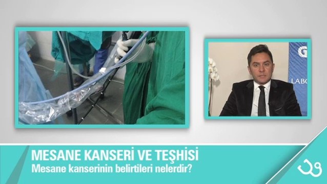 Mesane kanseri nasil teshis edilir